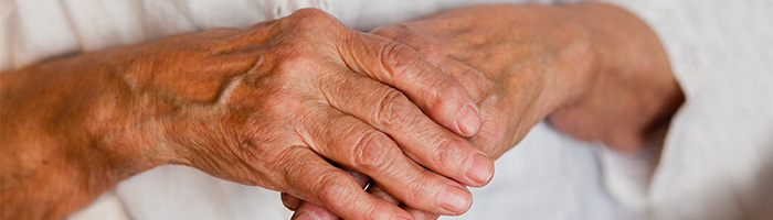 Imagen mujer mayor con artritis